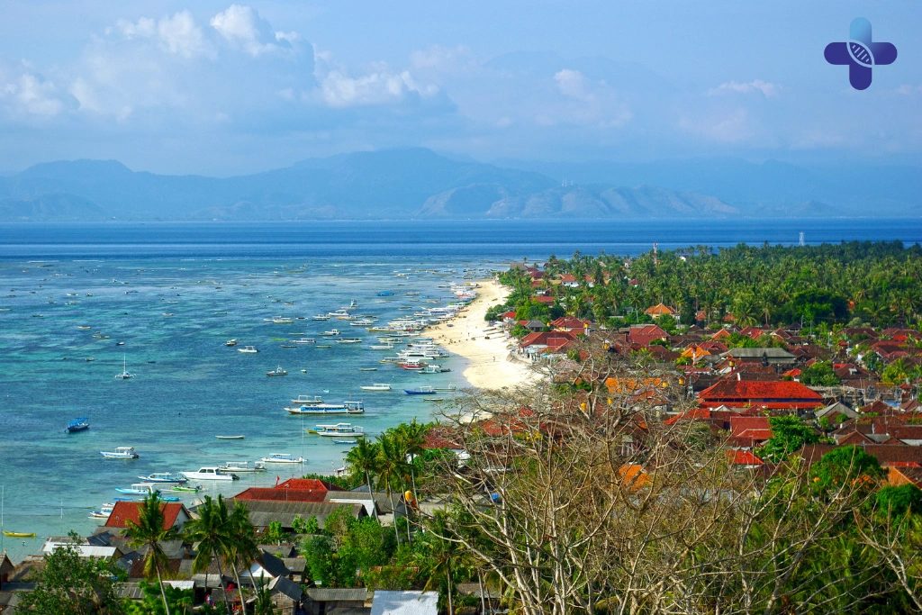 Conclusion When Holiday Fatigue Turns Into Something More in Bali (2025)
