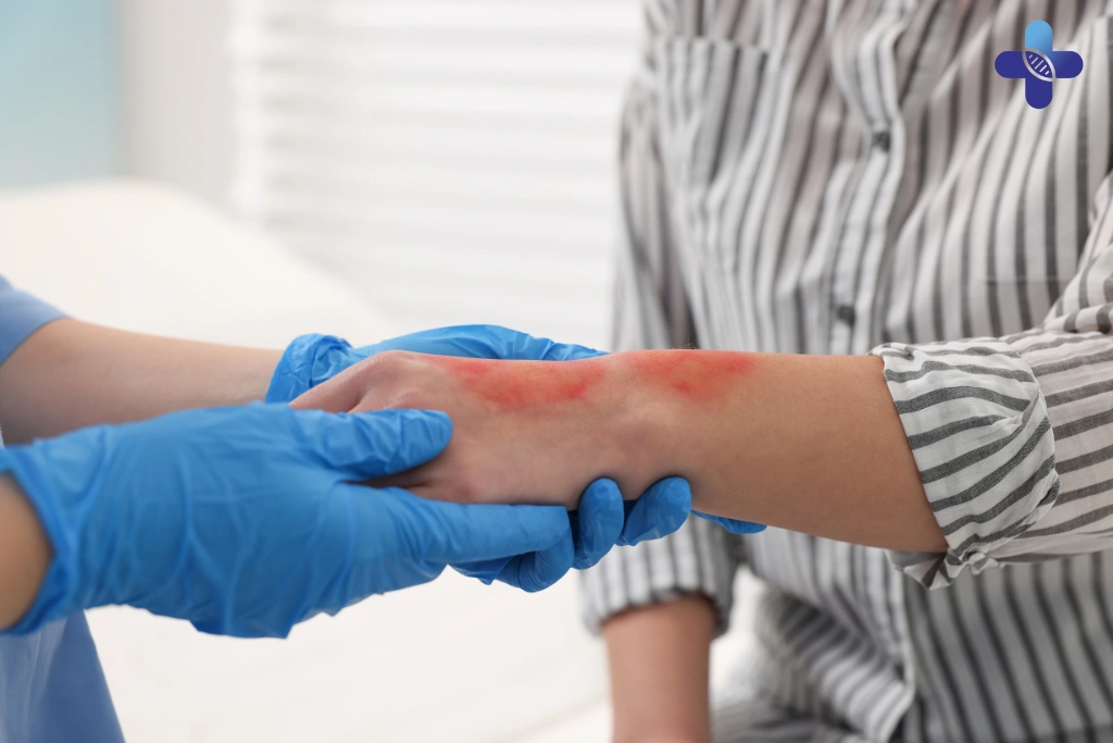 Medical Intervention for Rash and Fever