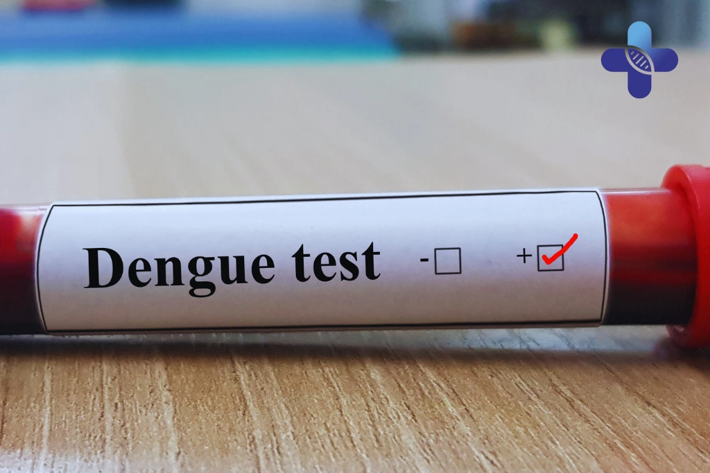 Why Tourists in Bali Should Never Delay Their Dengue Test