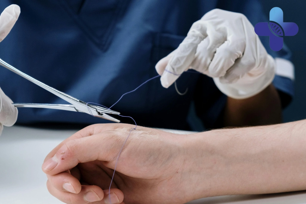 Options Travelers Commonly Use for Wound Care