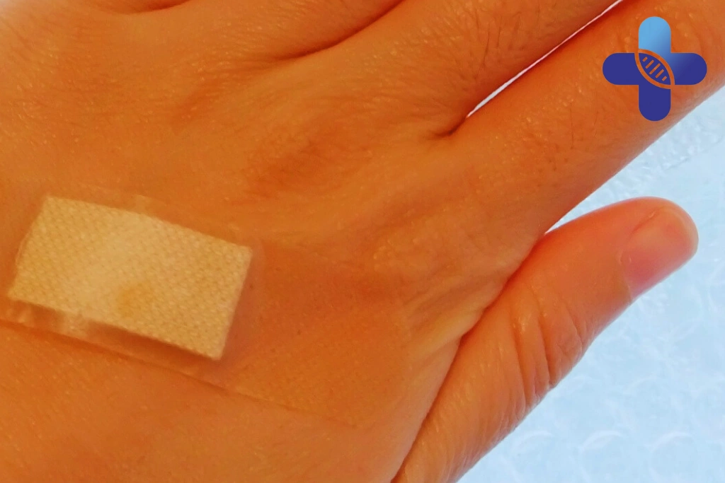 What Proper Wound Care Looks Like for Travelers in Bali