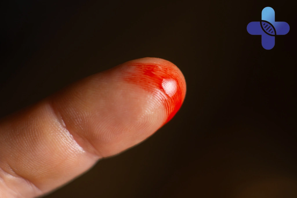 Why Small Cuts Become Painful or Swollen Faster in Bali’s Climate