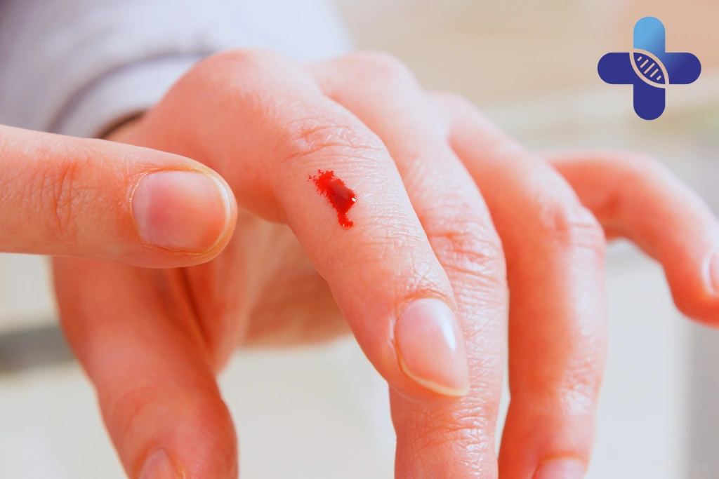 Why Small Skin Injuries Heal Slower in Bali’s Humid Climate