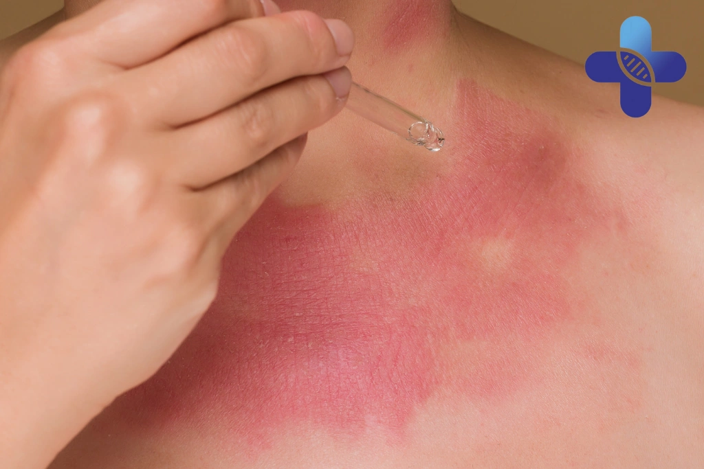 Why This Doesn’t Always Mean Infection