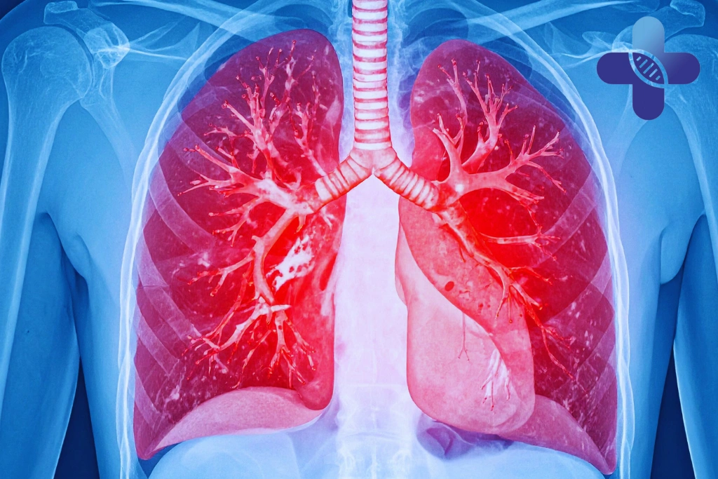 Common Situations Where Travelers May Encounter Viruses