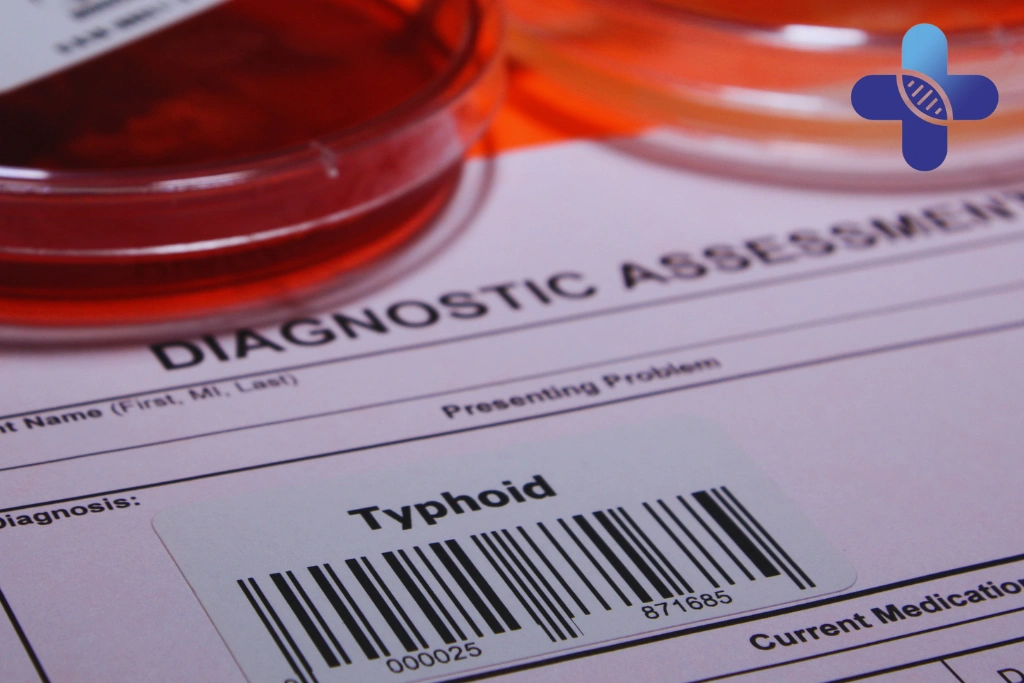 How Doctors Diagnose Typhoid in Bali Clinics