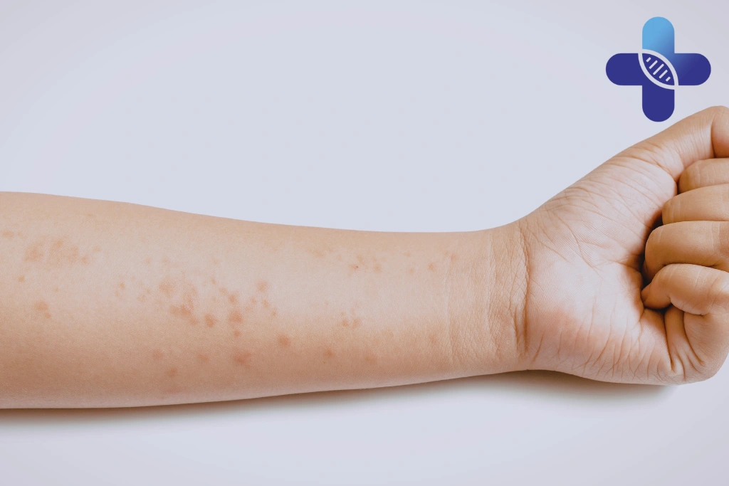 Minor Illnesses That Can Happen During a Bali Vacation