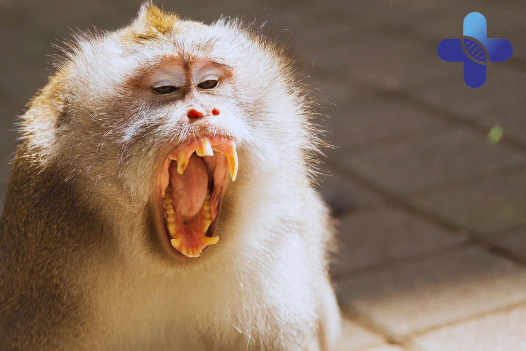 What to Do After a Dog or Monkey Bite in Bali (Step-by-Step Guide)