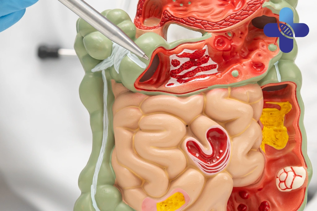 Conclusion - Stomach Reaction During Travel Bali_ Causes & What to Do