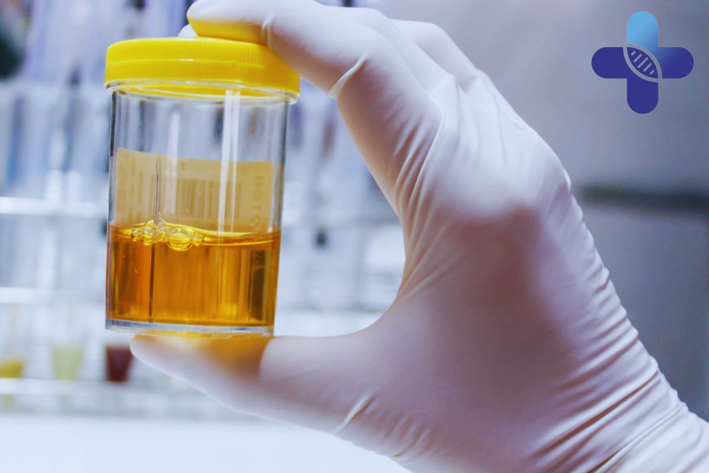 Blood, Urine, or Swab_ Types of STD Tests Available for Sanur Patients