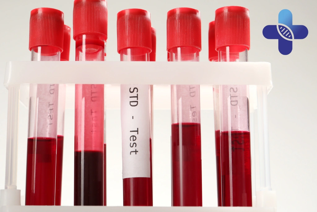 Choosing a Clinic for STD Testing Near Jimbaran