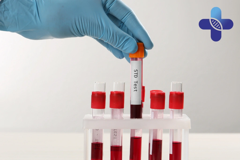 Conclusion - Home Visit HIV and STD Testing in Bali_ Private Villa and Hotel Screening