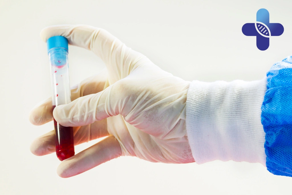 Does STD Testing Feel Painful