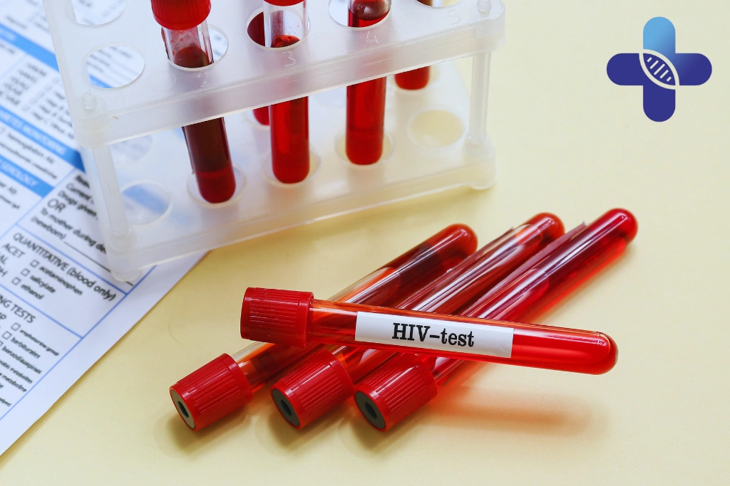 HIV Testing in Bali_ What Tourists Should Expect