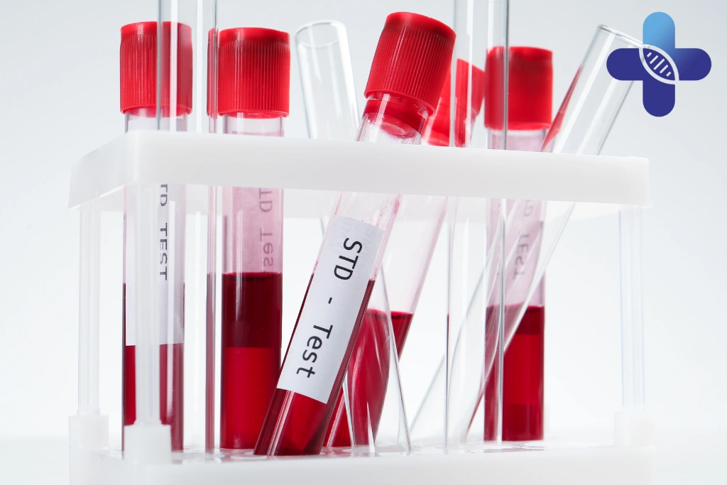 How Soon After Sex Should You Get STD Testing in Jimbaran