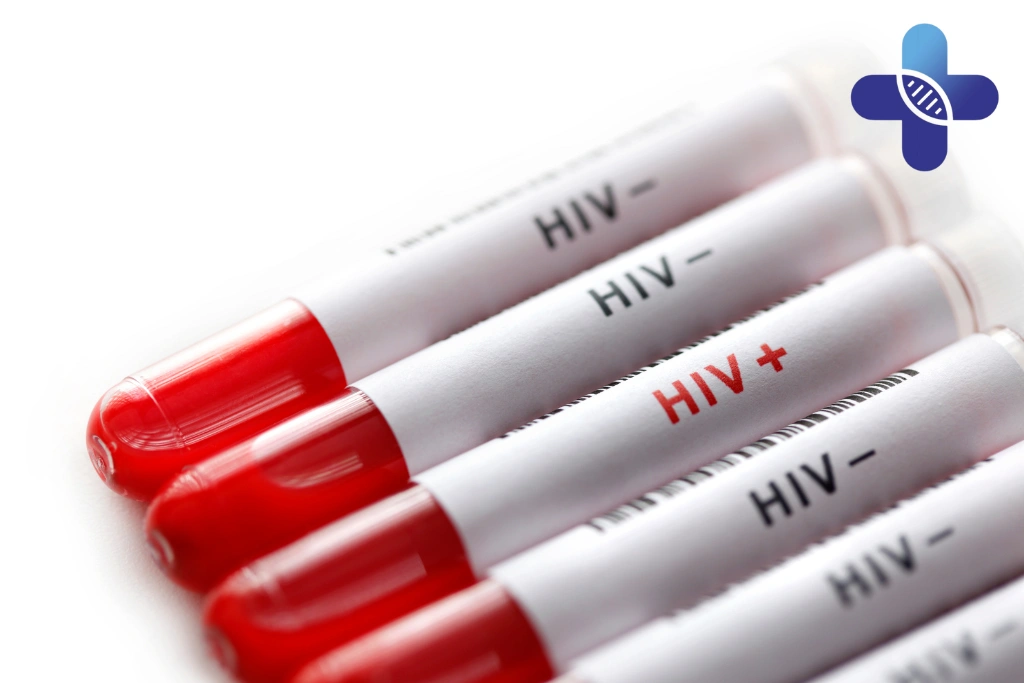 Is HIV Testing Confidential for Tourists