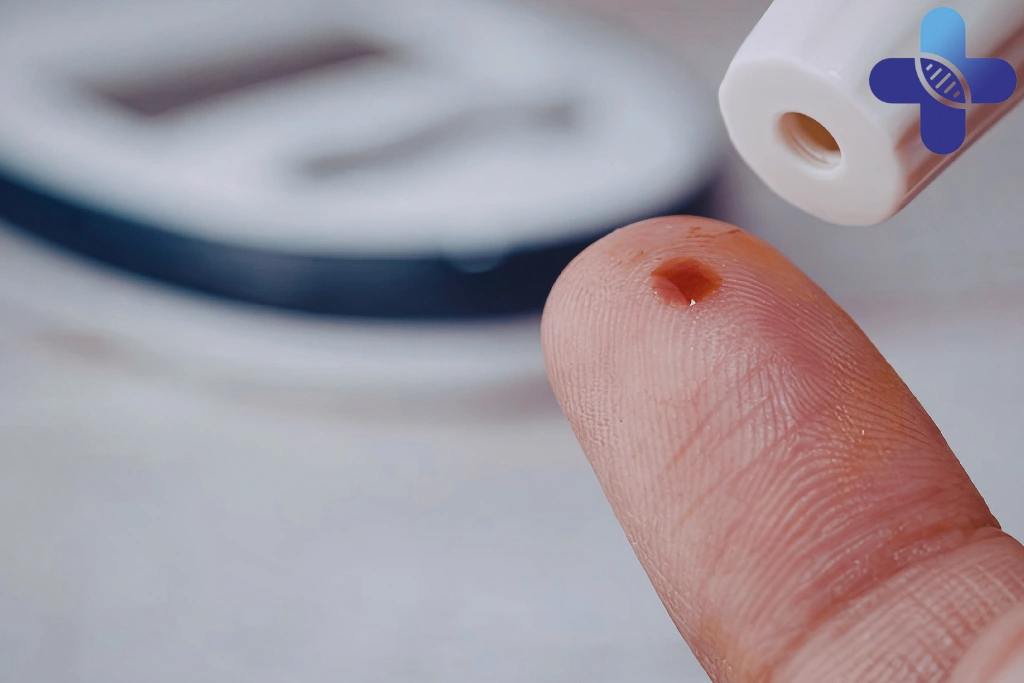 Private AIDS and STD Testing in Sanur for Travelers and Expats