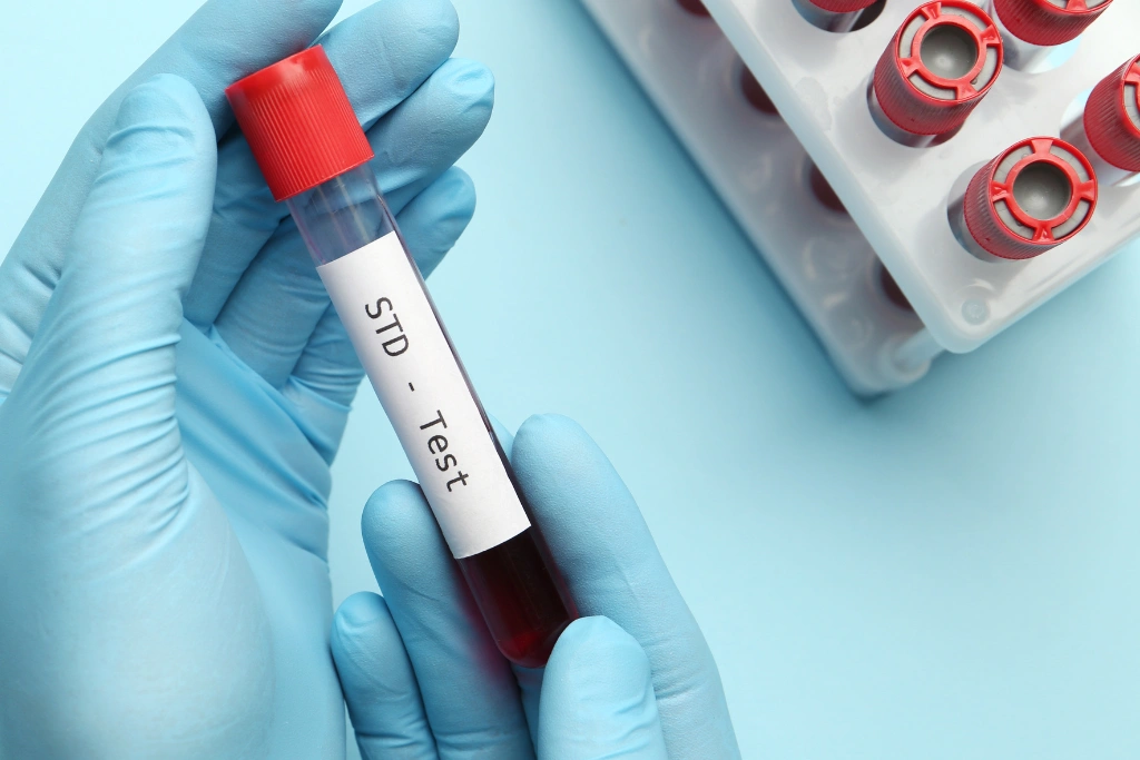 Private STD Testing in Jimbaran_ Confidential Care for Travelers and Expats