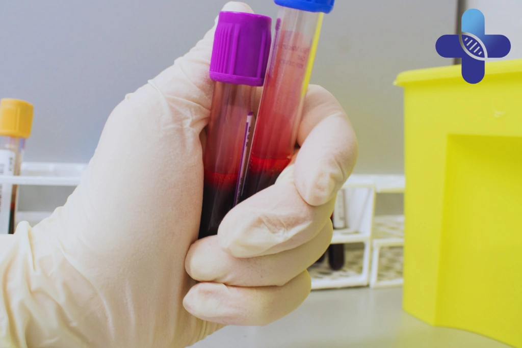 Private STD Testing in Sanur_ Why Early Testing Matters