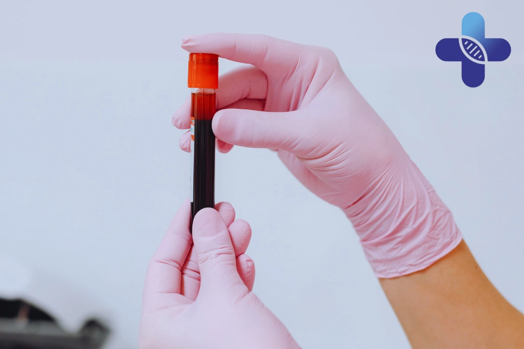 STD Testing in Bali After Possible HIV Exposure_ Why a Full Panel May Help