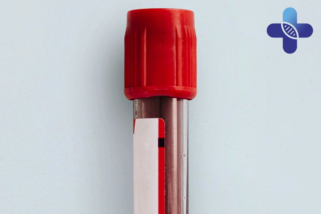 Should You Test If the Itching Comes and Goes