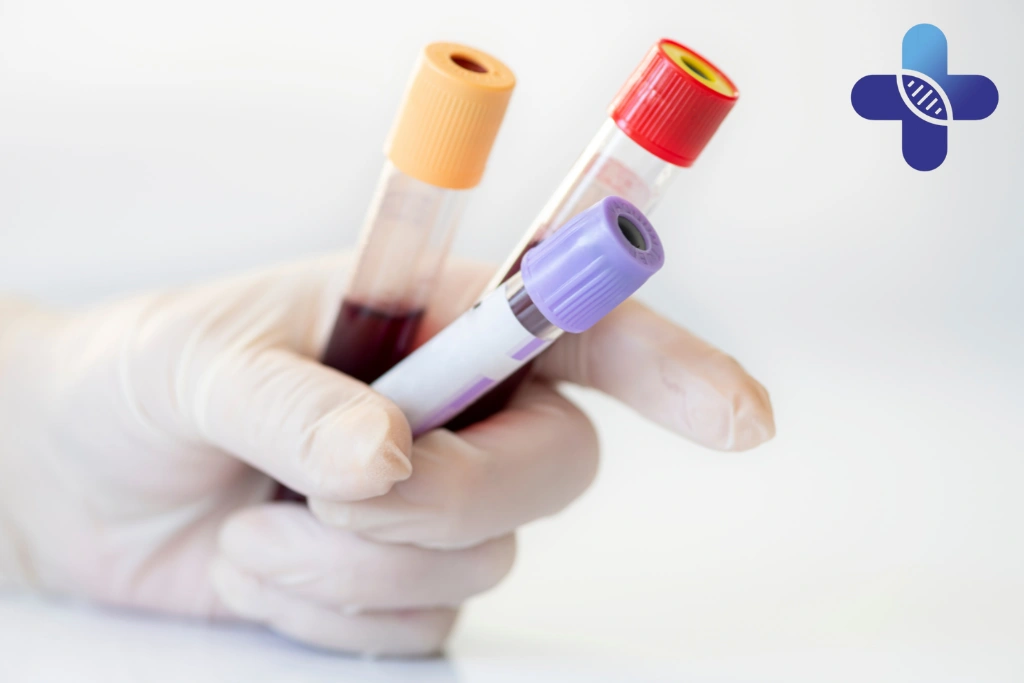 What Types of STD Tests May Be Used