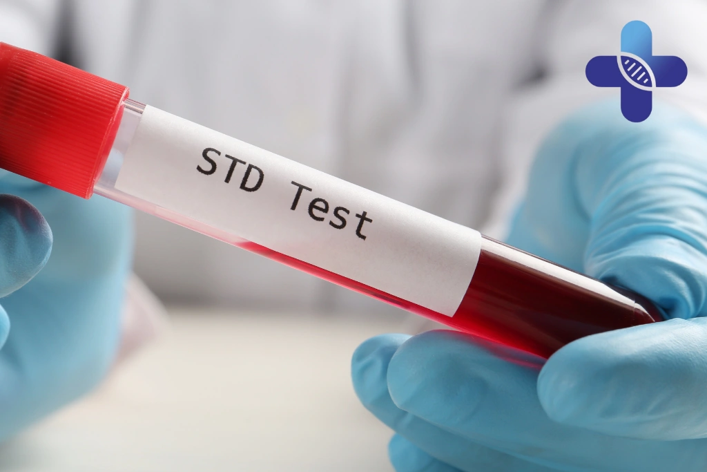What Usually Happens During STD Consultation