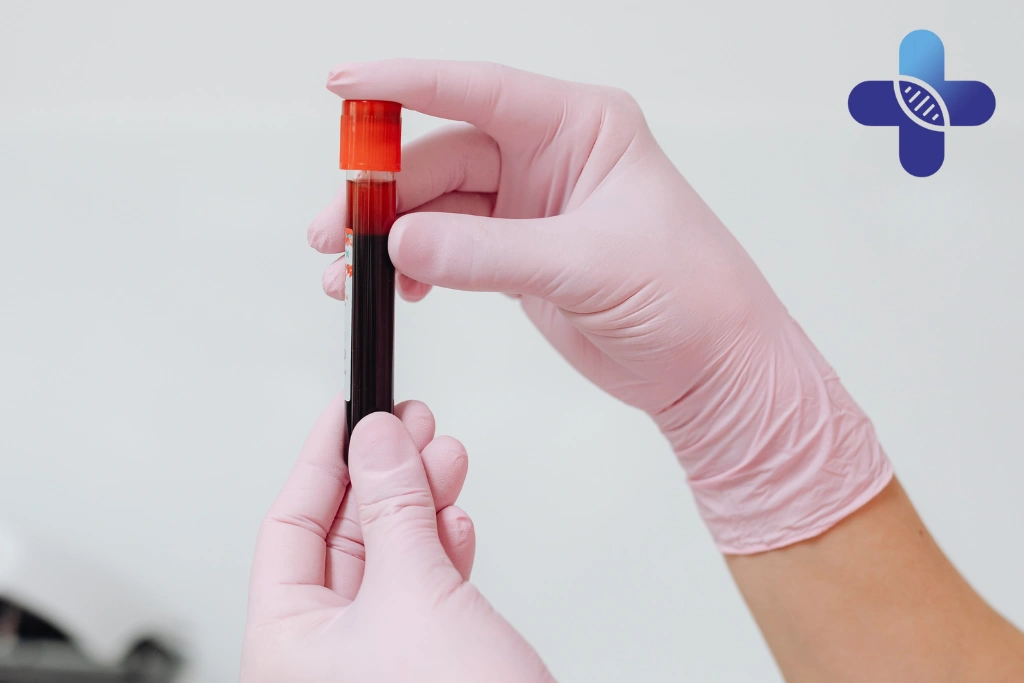 What Usually Happens During STD Consultation