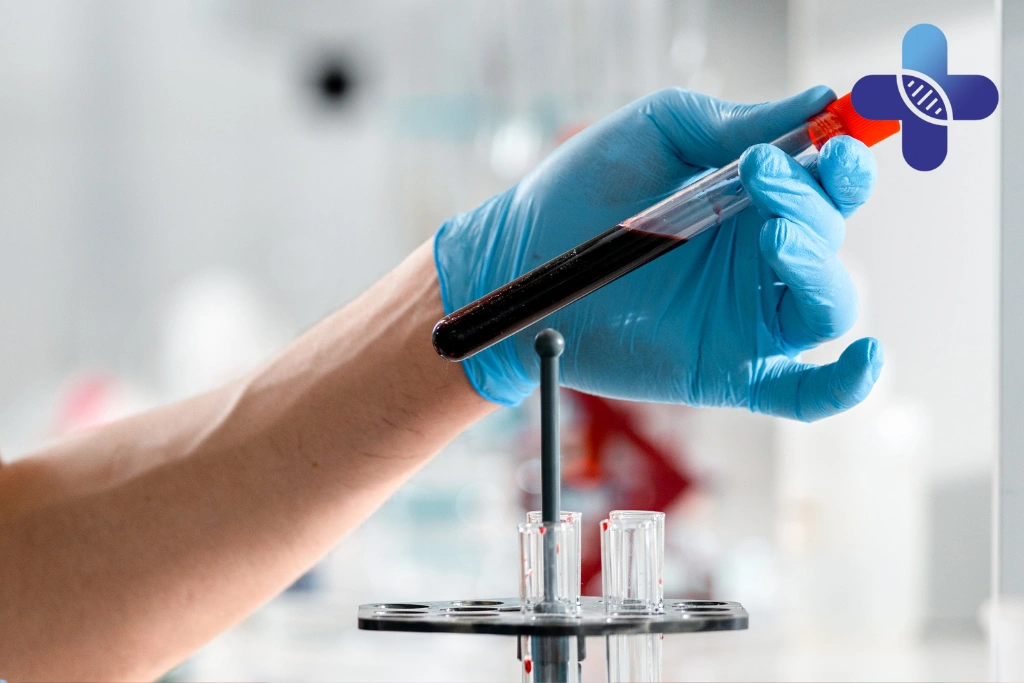 What to Expect During a Home Visit STD Test