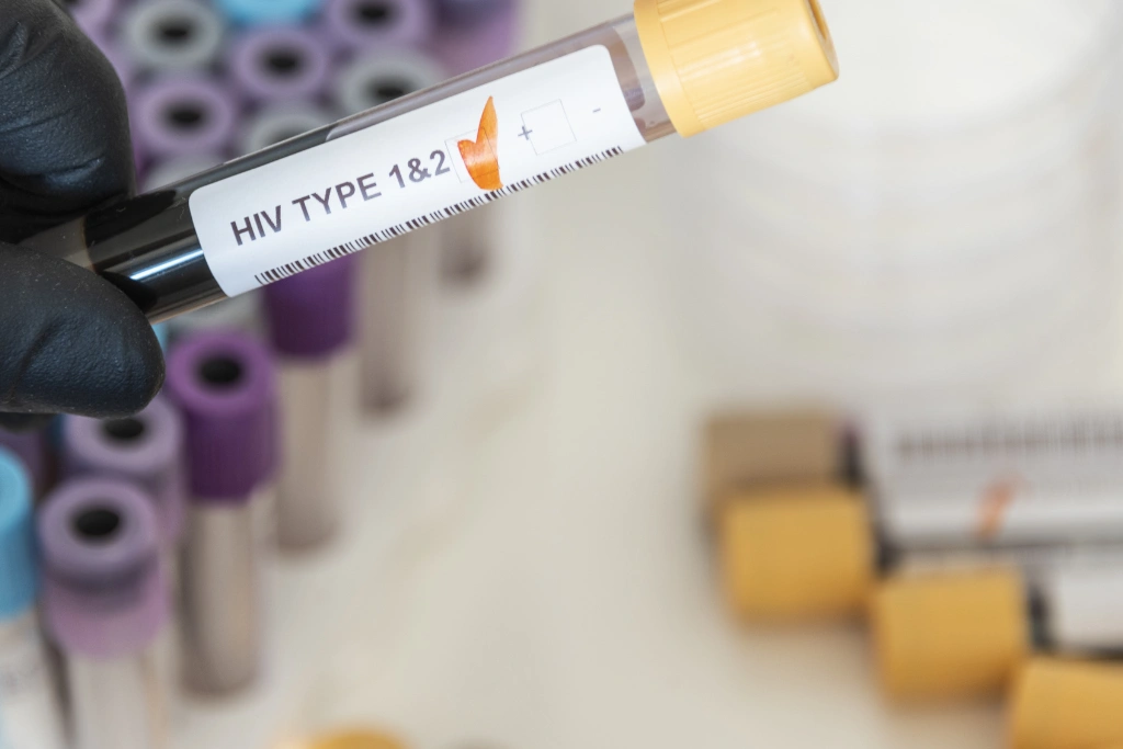 What to Expect During an STD Test in Jimbaran