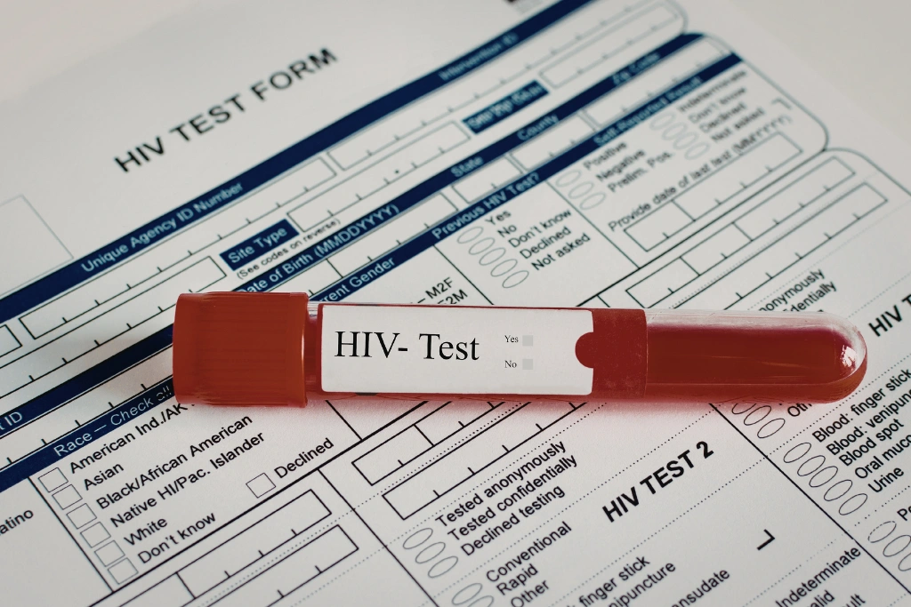 When Symptoms After Sex Should Prompt Medical Advice