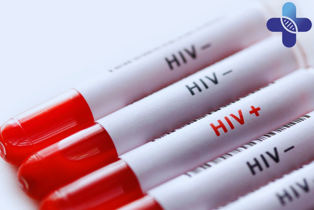 Where to Get Checked for AIDS-Related Risks in Bali