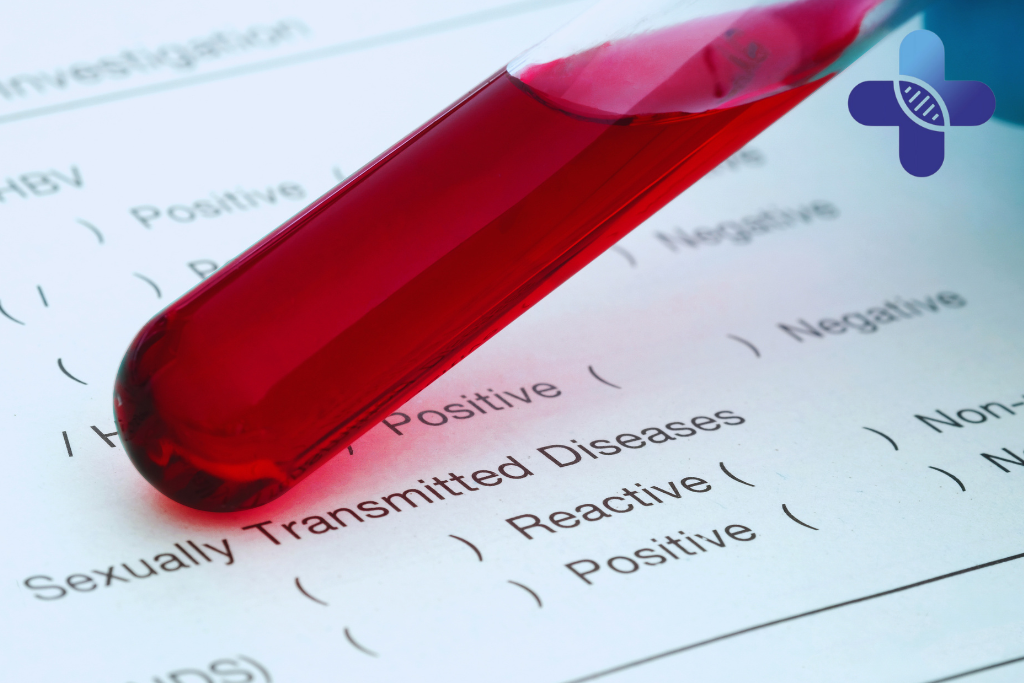 Why Early Detection Can Help Prevent AIDS-Related Complications