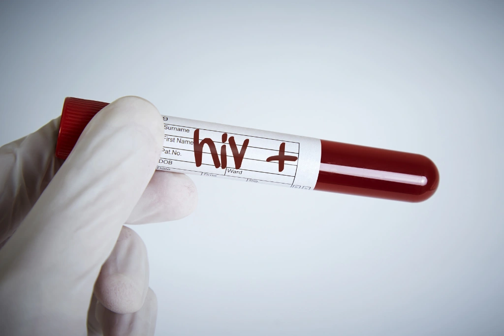 Why Symptom Timing Alone Cannot Confirm HIV