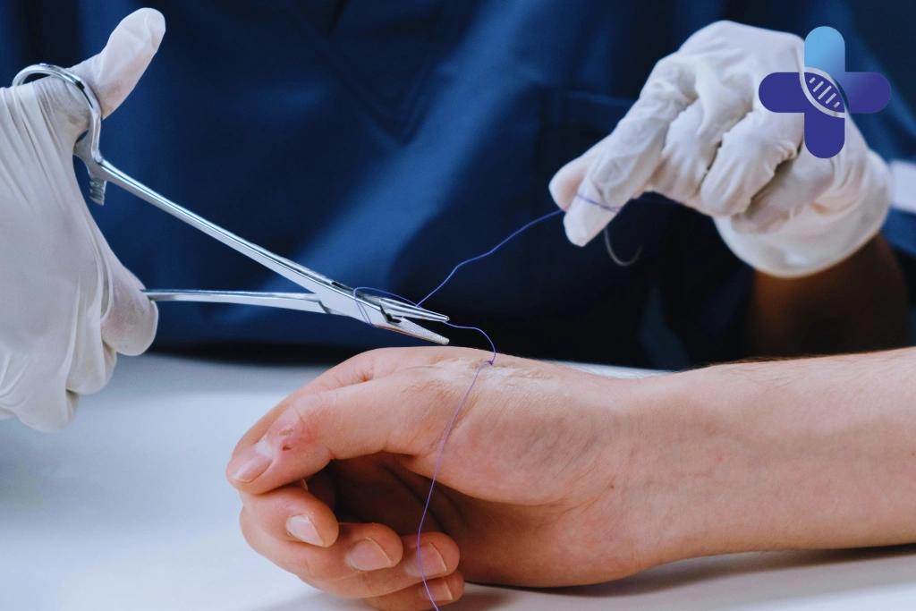 When the Wound Should Be Checked Promptly