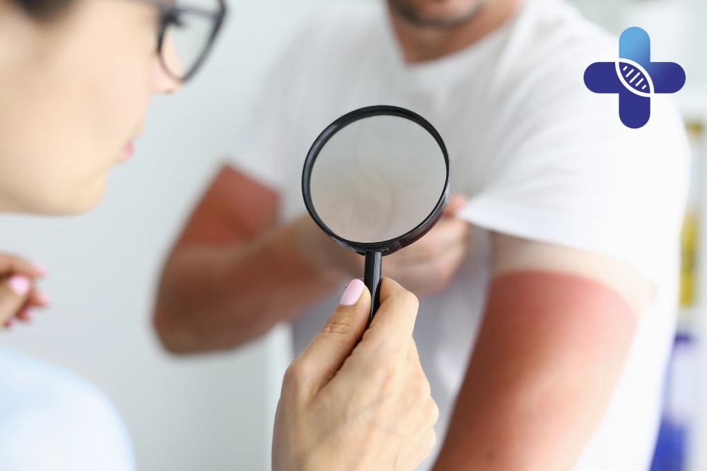 When Sunburn Becomes an Emergency