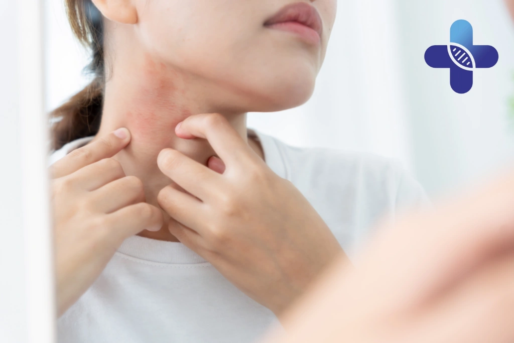 When a Doctor Should Examine the Rash