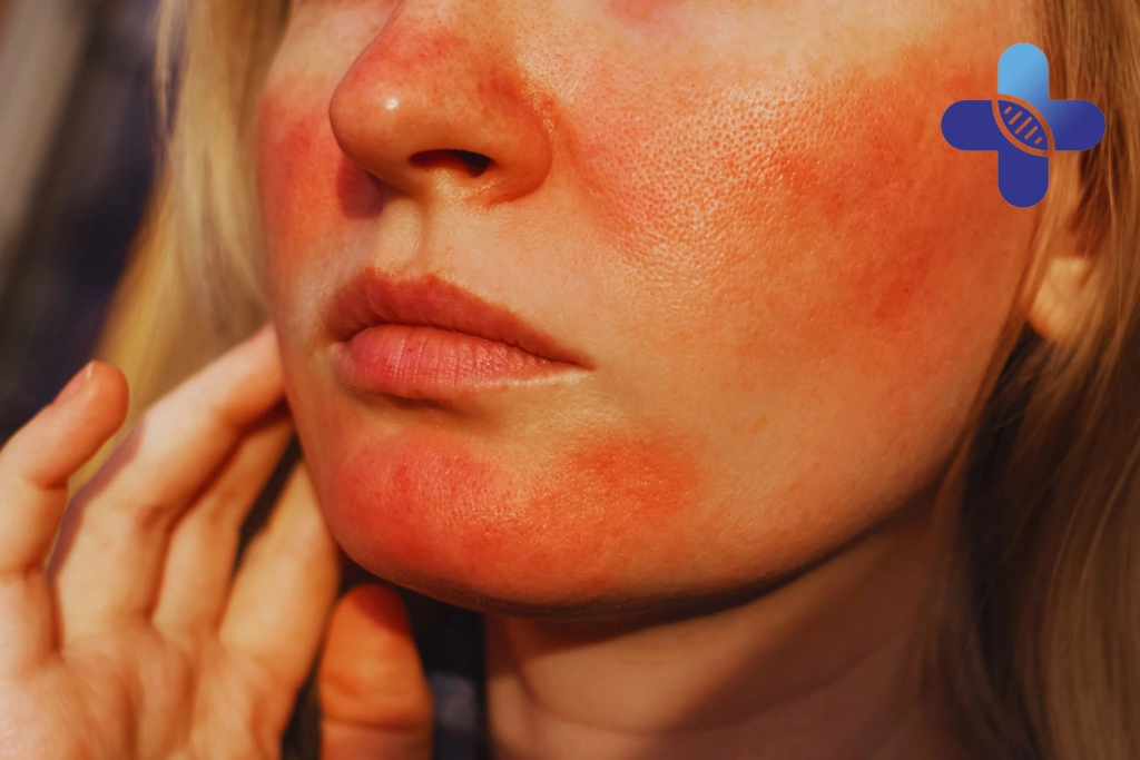 Sunburn Won't Heal_ Signs Your Skin Needs More Than Aloe Vera
