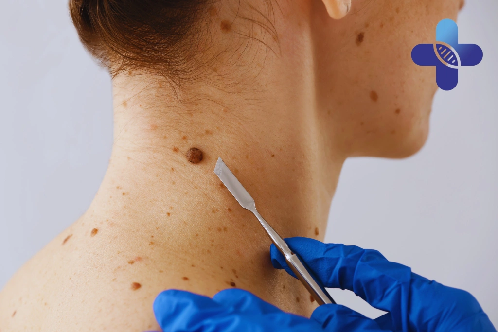 Why Bali's Sun Exposure Raises the Stakes 1